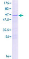 POU1F1 / PIT1 Protein - 12.5% SDS-PAGE of human POU1F1 stained with Coomassie Blue
