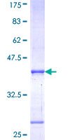 POU1F1 / PIT1 Protein - 12.5% SDS-PAGE Stained with Coomassie Blue.