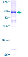 POU2F2 / OCT2 Protein - 12.5% SDS-PAGE of human POU2F2 stained with Coomassie Blue