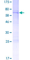 POU3F4 Protein - 12.5% SDS-PAGE of human POU3F4 stained with Coomassie Blue