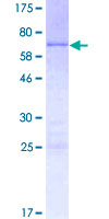POU4F1 / BRN3A Protein - 12.5% SDS-PAGE of human POU4F1 stained with Coomassie Blue
