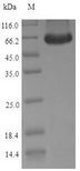 POU5F1 / OCT4 Protein - (Tris-Glycine gel) Discontinuous SDS-PAGE (reduced) with 5% enrichment gel and 15% separation gel.