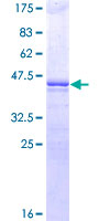 POU5F1 / OCT4 Protein - 12.5% SDS-PAGE of human POU5F1 stained with Coomassie Blue