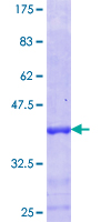 POU5F2 Protein - 12.5% SDS-PAGE Stained with Coomassie Blue.