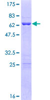 POU6F1 / BRN5 Protein - 12.5% SDS-PAGE of human POU6F1 stained with Coomassie Blue