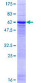 PP2Ac / PPP2CA Protein - 12.5% SDS-PAGE of human PPP2CA stained with Coomassie Blue