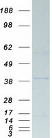 PP2Ac / PPP2CA Protein - Purified recombinant protein PPP2CA was analyzed by SDS-PAGE gel and Coomassie Blue Staining