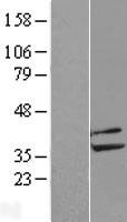 PP2CB / PPP2CB Protein - Western validation with an anti-DDK antibody * L: Control HEK293 lysate R: Over-expression lysate