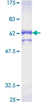 PP2CB / PPP2CB Protein - 12.5% SDS-PAGE of human PPP2CB stained with Coomassie Blue