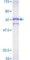 PP2CB / PPP2CB Protein - 12.5% SDS-PAGE of human PPP2CB stained with Coomassie Blue