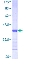 PPA1 Protein - 12.5% SDS-PAGE Stained with Coomassie Blue.