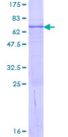 PPA2 Protein - 12.5% SDS-PAGE of human PPA2 stained with Coomassie Blue