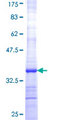 PPA2 Protein - 12.5% SDS-PAGE Stained with Coomassie Blue