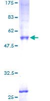 PPAP2C Protein - 12.5% SDS-PAGE of human PPAP2C stained with Coomassie Blue