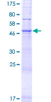 PPAPDC3 Protein - 12.5% SDS-PAGE of human PPAPDC3 stained with Coomassie Blue
