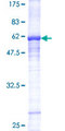 PPARA / PPAR Alpha Protein - 12.5% SDS-PAGE of human PPARA stained with Coomassie Blue