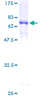 PPARD / PPAR Delta Protein - 12.5% SDS-PAGE of human PPARD stained with Coomassie Blue
