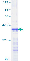 PPARD / PPAR Delta Protein - 12.5% SDS-PAGE Stained with Coomassie Blue.