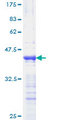 PPARD / PPAR Delta Protein - 12.5% SDS-PAGE Stained with Coomassie Blue.