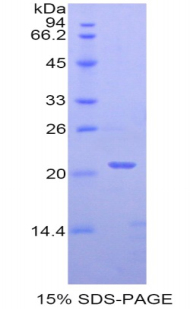 PPARD / PPAR Delta Protein - Recombinant Peroxisome Proliferator Activated Receptor Delta By SDS-PAGE