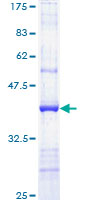 PPARG / PPAR Gamma Protein - 12.5% SDS-PAGE Stained with Coomassie Blue.