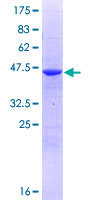 PPCDC Protein - 12.5% SDS-PAGE of human PPCDC stained with Coomassie Blue