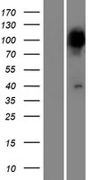 PPEF2 Protein - Western validation with an anti-DDK antibody * L: Control HEK293 lysate R: Over-expression lysate