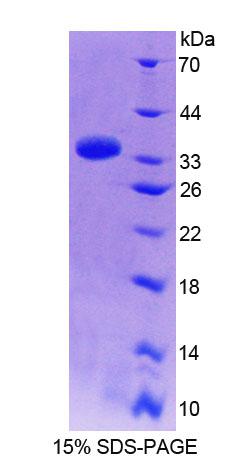 PPFIA1 / LIPRIN Protein - Recombinant Protein Tyrosine Phosphatase F Interacting Protein 1 (PPFIA1) by SDS-PAGE