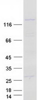 PPFIA1 / LIPRIN Protein - Purified recombinant protein PPFIA1 was analyzed by SDS-PAGE gel and Coomassie Blue Staining