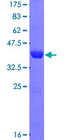 PPFIBP2 Protein - 12.5% SDS-PAGE Stained with Coomassie Blue.