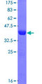 PPFIBP2 Protein - 12.5% SDS-PAGE Stained with Coomassie Blue.