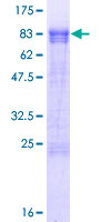 PPHLN1 Protein - 12.5% SDS-PAGE of human PPHLN1 stained with Coomassie Blue