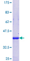 PPHLN1 Protein - 12.5% SDS-PAGE Stained with Coomassie Blue.