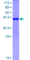 PPIA / Cyclophilin A Protein - 12.5% SDS-PAGE of human PPIA stained with Coomassie Blue