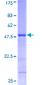 PPIB / Cyclophilin B Protein - 12.5% SDS-PAGE of human PPIB stained with Coomassie Blue