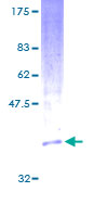 PPIC / Cyclophilin C Protein - 12.5% SDS-PAGE Stained with Coomassie Blue.