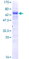 PPID / Cyclophilin D Protein - 12.5% SDS-PAGE of human PPID stained with Coomassie Blue