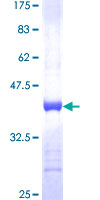 PPIE / Cyclophilin E Protein - 12.5% SDS-PAGE Stained with Coomassie Blue.