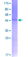 PPIF / Cyclophilin F Protein - 12.5% SDS-PAGE of human PPIF stained with Coomassie Blue