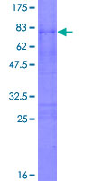 PPIG / Cyclophilin G Protein - 12.5% SDS-PAGE of human PPIG stained with Coomassie Blue