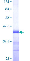 PPIG / Cyclophilin G Protein - 12.5% SDS-PAGE Stained with Coomassie Blue.