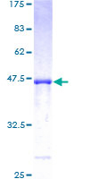 PPIH / Cyclophilin H Protein - 12.5% SDS-PAGE of human PPIH stained with Coomassie Blue