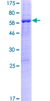 PPIL6 Protein - 12.5% SDS-PAGE of human PPIL6 stained with Coomassie Blue