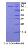 PPL / Periplakin Protein - Recombinant Periplakin By SDS-PAGE