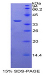 PPL / Periplakin Protein - Recombinant Periplakin By SDS-PAGE