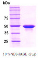 PPM1A / PP2CA Protein