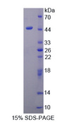 PPM1A / PP2CA Protein - Recombinant  Protein Phosphatase, Mg2+/Mn2+ Dependent 1A By SDS-PAGE