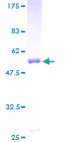 PPM1B Protein - 12.5% SDS-PAGE of human PPM1B stained with Coomassie Blue