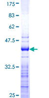 PPM1D / WIP1 Protein - 12.5% SDS-PAGE Stained with Coomassie Blue.