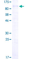 PPM1D / WIP1 Protein - 12.5% SDS-PAGE of human PPM1D stained with Coomassie Blue